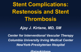 Stent Thrombosis and Restenosis