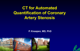 CT for Automated Quantification of Coronary Artery Stenosis