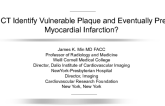 Can CT Identify Vulnerable Plaque and Eventually Predict Myocardial Infarction?