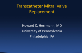Transcatheter Mitral Valve Replacement