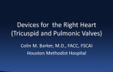 Devices for the Right Heart (Tricuspid and Pulmonic Valves)