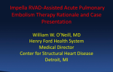 Impella RVAD-Assisted Acute Pulmonary Embolism Therapy: Rationale and Case Presentation
