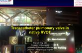 Native RVOT and RV-PA Conduit Transcatheter Pulmonary Valve Replacement