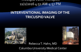 Interventional Imaging of the Tricuspid Valve