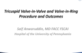 Tricuspid Valve-in-Valve and Valve-in-Ring Procedures and Outcomes