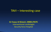 Saudi Arabia Presents: A Case of Coronary Compression After TAVR