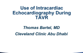 Use of Intracardiac Echocardiography During TAVR