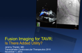 Fusion Imaging for TAVR: Is There Added Utility?