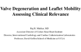 Valve Degeneration and Mobility Considerations: Assessing Clinical Relevance