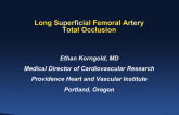 Case Presentation: Long SFA CTO