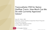 Transcatheter PVR for Native Outflow Tracts: How Much Can We Do With the Currently Approved Valves (Including Hybrid)?