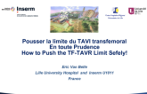 Pousser La Limite Du TAVI Transfemoral En Toute Prudence/How to Push the TF-TAVR Limit Safely!