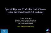 Special Tips and Tricks for LAA Closure Using the WaveCrest LAA Occluder