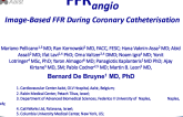 FFRangio: Image-Based FFR During Coronary Catheterisation