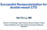 TCT 1097: Successful Revascularization for Double-Vessel CTO