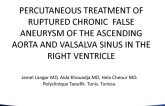 TCT 1499: Percutaneous Treatment of Ruptured Chronic False Aneurysm of the Ascending Aorta and Valsalva Sinus in the Right Ventricule