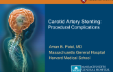 Managing Complications of Carotid Interventions