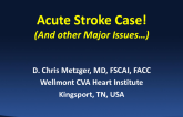 VIDEOTAPED CASE DEMONSTRATION: Interventional Management of Acute Stroke