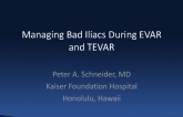 Managing Bad Iliacs During EVAR and TEVAR