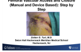 Femoral Vascular Access and Closure (Manual and Device Based): A Step-by-Step Approach