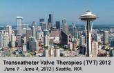 TVT 2012