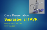 Case Presentation: Suprasternal TAVR