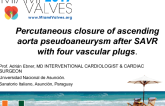 Percutaneous Closure of Ascending Aorta Pseudoaneurysm after SAVR with Four Vascular Plugs