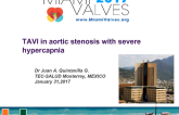 TAVI in Aortic Stenosis with Severe Hypercapnia 