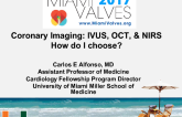 Coronary Imaging: IVUS, OCT, & NIRS How do I choose?