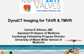DynaCT Imaging for TAVR & TMVR