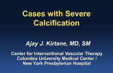 Cases with Severe Calcification