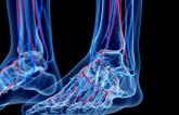Low Ankle-Brachial Index a Harbinger of Poor Physical QoL and Lack of Mental Vitality