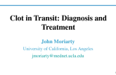 Clot in Transit: Diagnosis and Treatment
