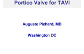 Portico Valve for TAVI