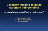 Is stent malapposition a real issue?