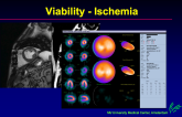 Assessment of Ischemia in CTOs