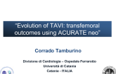 “Evolution of TAVI: transfemoral outcomes using ACURATE neo” 