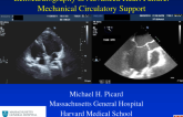 Echocardiography in the Management of Patients With Left Ventricular Assist Devices