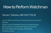 How to Perform Watchman