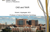 Coronary Disease and TAVR