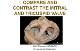 Compare and Contrast The Mitral and Tricuspid Valve