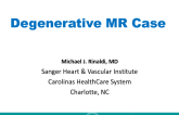 Degenarative MR Case