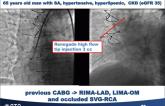 CTO PCI in Patients With Renal Insufficiency