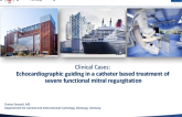 Clinical Cases: Echocardiographic Guiding in a Catheter Based Treatment of Severe Functional Mitral Regurgitation