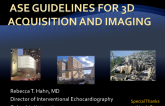 ASE Guidelines for 3D Adquisition and Imaging
