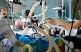 Cardiac Intensive Care Units Face an Ever More Complex Patient Population