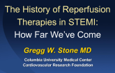 The History of Reperfusion Therapies in STEMI: How Far We've Come