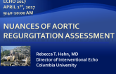 Nuances of Aortic Regurgitation Assessment