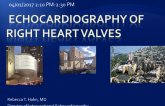 Echocardiography of Right Heart Valves