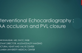Interventional Echocardiography II: PVL and LAA Closure
